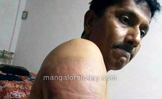 man attacked